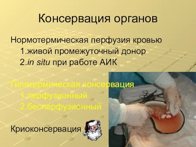 Консервация органов Нормотермическая перфузия кровью 1.живой промежуточный донор 2.in situ при работе