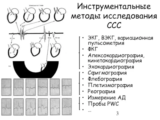 Инструментальные методы исследования ССС ЭКГ, ВЭКГ, вариационная пульсометрия ФКГ Апексокардиография, кинетокардиография Эхокардиография