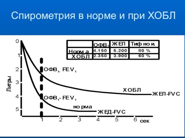 Спирометрия в норме и при ХОБЛ