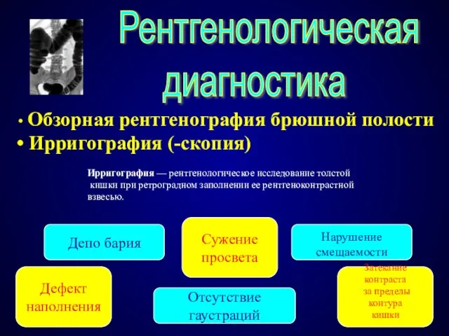 Рентгенологическая диагностика Обзорная рентгенография брюшной полости Ирригография (-скопия) Ирригография — рентгенологическое исследование