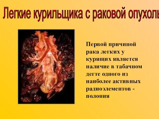 Первой причиной рака легких у курящих является наличие в табачном дегте одного