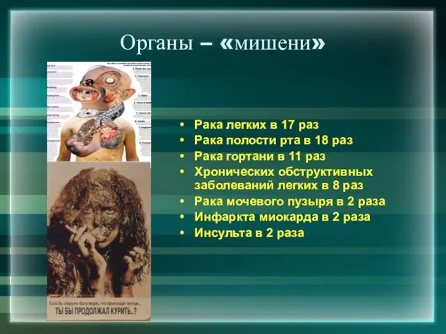 Органы – «мишени» Рака легких в 17 раз Рака полости рта в