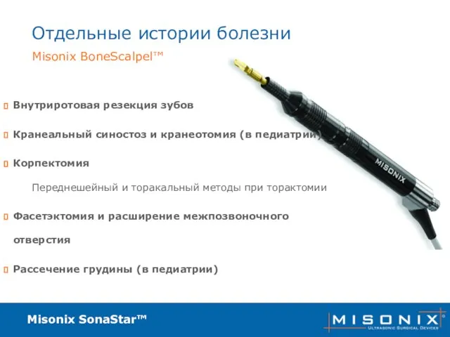 Misonix SonaStar™ Отдельные истории болезни Внутриротовая резекция зубов Кранеальный синостоз и кранеотомия