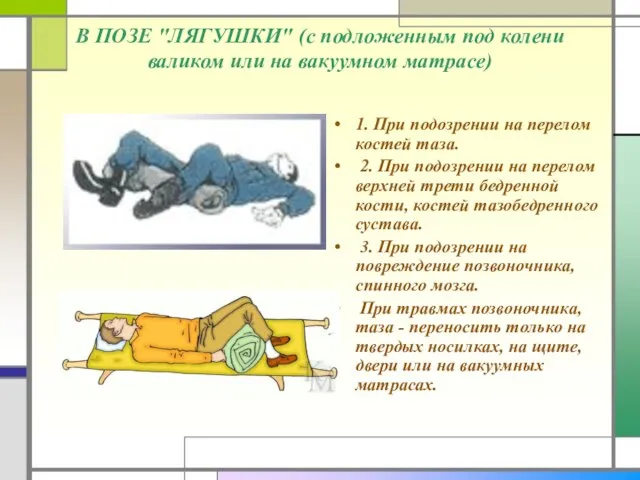 В ПОЗЕ "ЛЯГУШКИ" (с подложенным под колени валиком или на вакуумном матрасе)