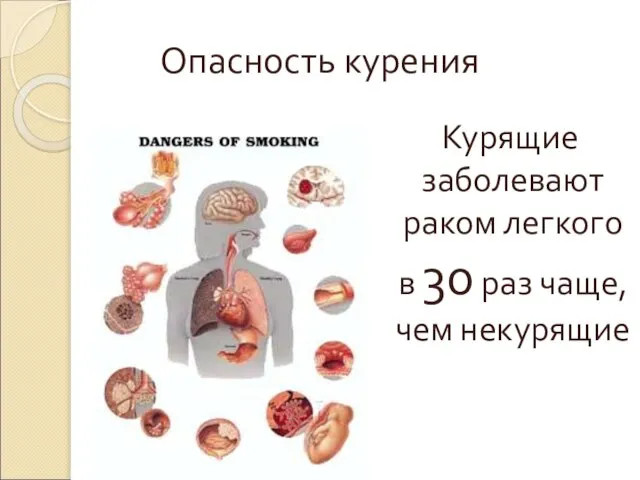 Опасность курения Курящие заболевают раком легкого в 30 раз чаще, чем некурящие