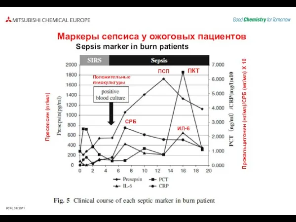 Sepsis marker in burn patients Маркеры сепсиса у ожоговых пациентов Пресепсин (пг/мл)