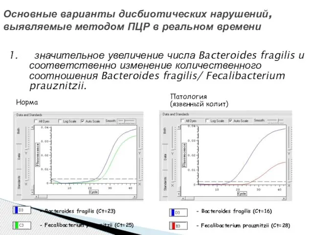 Основные варианты дисбиотических нарушений, выявляемые методом ПЦР в реальном времени 1. значительное