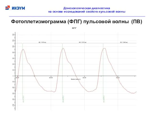 Фотоплетизмограмма (ФПГ) пульсовой волны (ПВ) Донозологическая диагностика на основе исследований свойств пульсовой волны