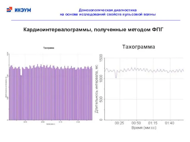 Кардиоинтервалограммы, полученные методом ФПГ Донозологическая диагностика на основе исследований свойств пульсовой волны