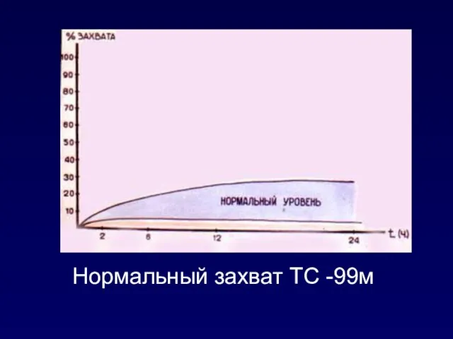 Нормальный захват ТС -99м