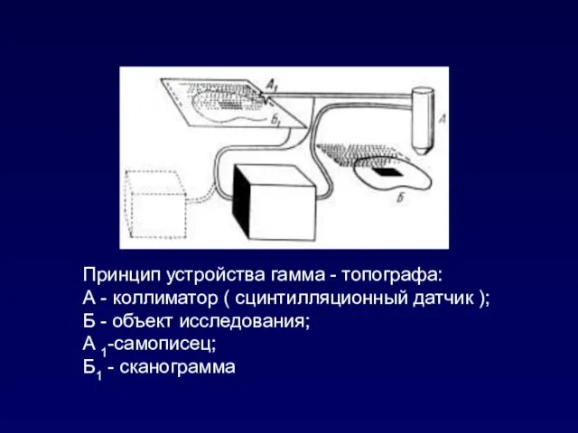 Принцип устройства гамма - топографа: А - коллиматор ( сцинтилляционный датчик );