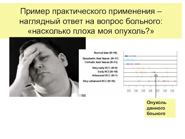 Пример практического применения – наглядный ответ на вопрос больного: «насколько плоха моя опухоль?» Опухоль данного боьного