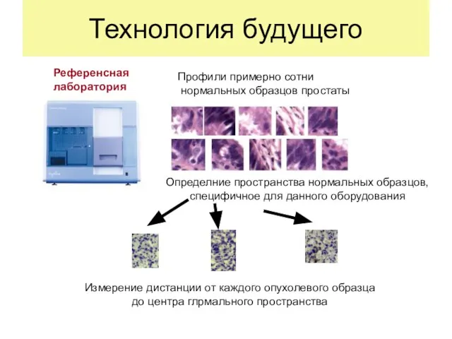 Технология будущего Референсная лаборатория Профили примерно сотни нормальных образцов простаты Определние пространства