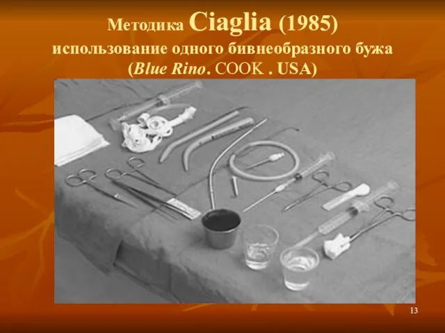 Методика Ciaglia (1985) использование одного бивнеобразного бужа (Blue Rino. COOK . USA)