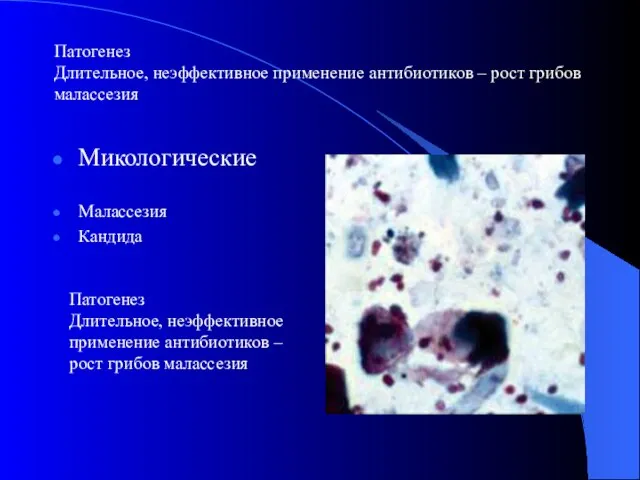 Патогенез Длительное, неэффективное применение антибиотиков – рост грибов малассезия Микологические Малассезия Кандида