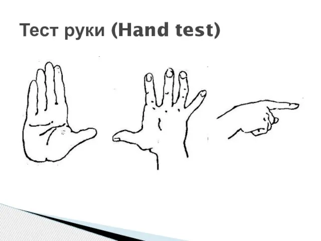 Тест руки (Hand test)