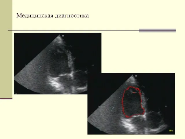 Медицинская диагностика