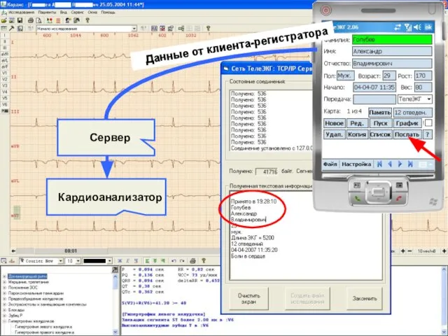 Сервер Кардиоанализатор Данные от клиента-регистратора