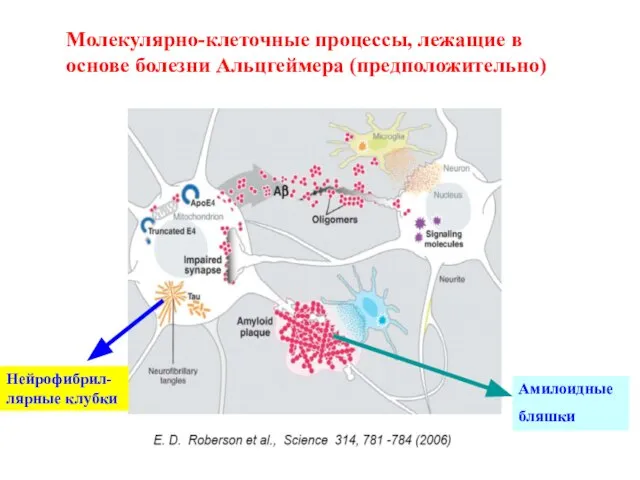 Молекулярно-клеточные процессы, лежащие в основе болезни Альцгеймера (предположительно) Амилоидные бляшки Нейрофибрил-лярные клубки