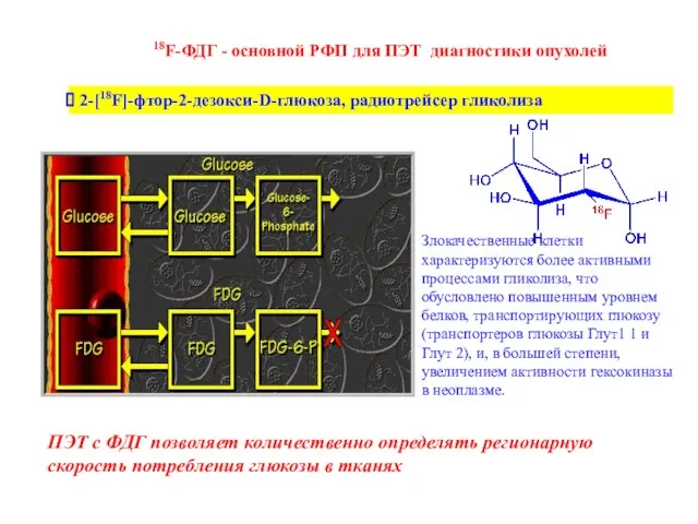 18F-ФДГ - основной РФП для ПЭТ диагностики опухолей 2-[18F]-фтор-2-дезокси-D-глюкоза, радиотрейсер гликолиза Злокачественные