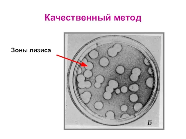 Качественный метод Зоны лизиса