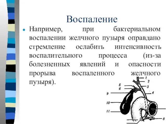 Воспаление Например, при бактериальном воспалении желчного пузыря оправдано стремление ослабить интенсивность воспалительного