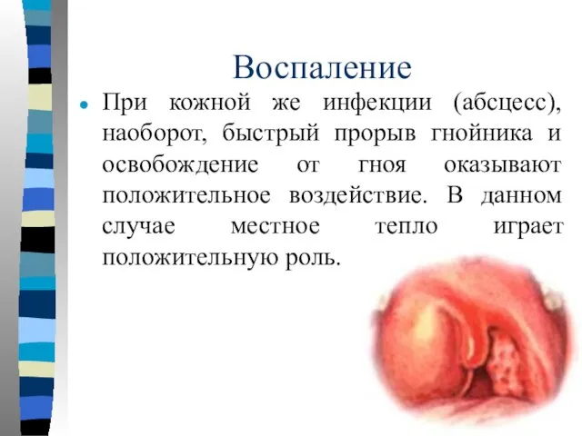 Воспаление При кожной же инфекции (абсцесс), наоборот, быстрый прорыв гнойника и освобождение