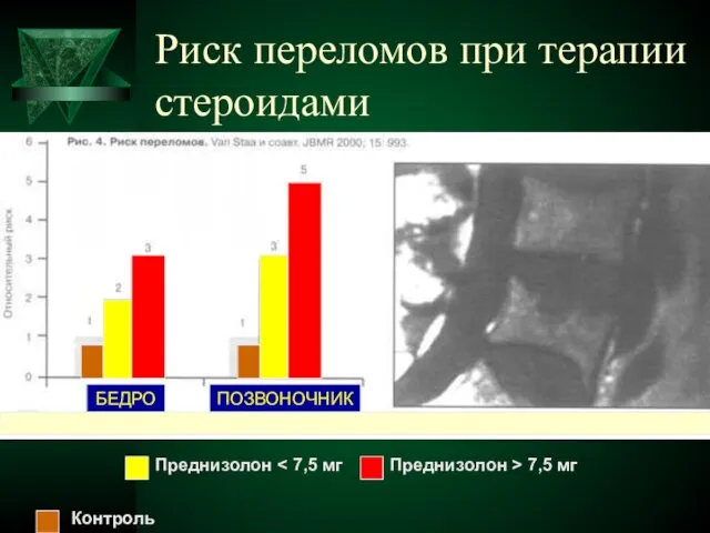 Риск переломов при терапии стероидами Преднизолон Преднизолон > 7,5 мг Контроль