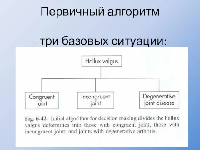 Первичный алгоритм - три базовых ситуации: