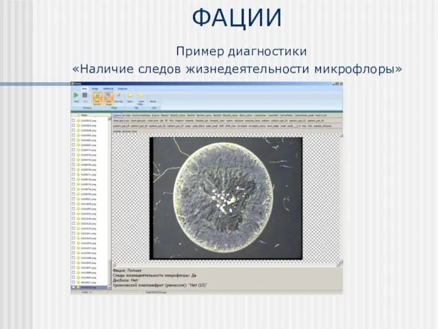 ФАЦИИ Пример диагностики «Наличие следов жизнедеятельности микрофлоры»