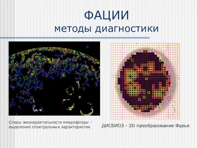 ФАЦИИ методы диагностики ДИСБИОЗ - 2D преобразование Фурье Следы жизнедеятельности микрофлоры – выделение спектральных характеристик