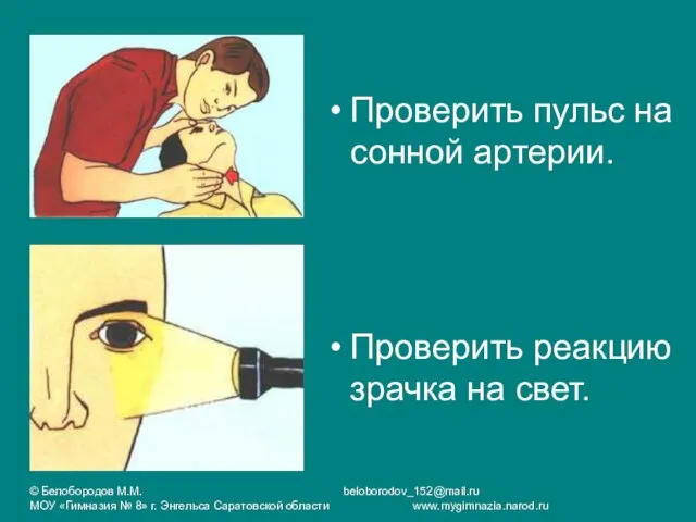 Проверить пульс на сонной артерии. Проверить реакцию зрачка на свет. © Белобородов