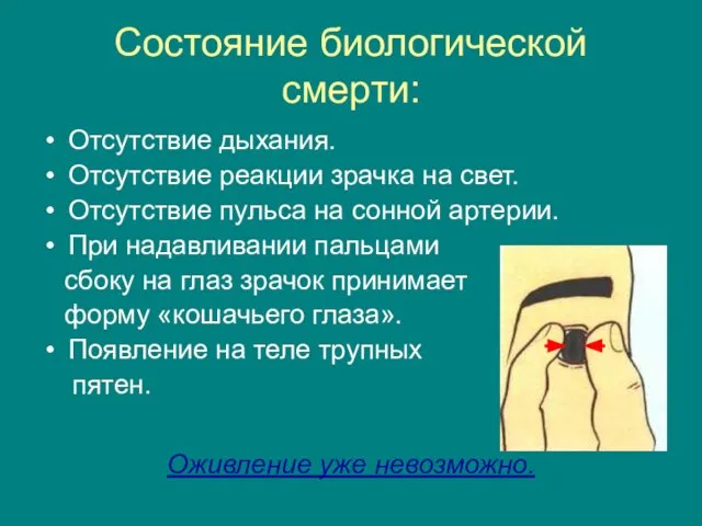 Состояние биологической смерти: Отсутствие дыхания. Отсутствие реакции зрачка на свет. Отсутствие пульса