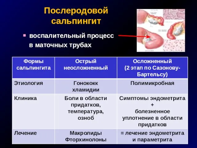 Послеродовой сальпингит воспалительный процесс в маточных трубах