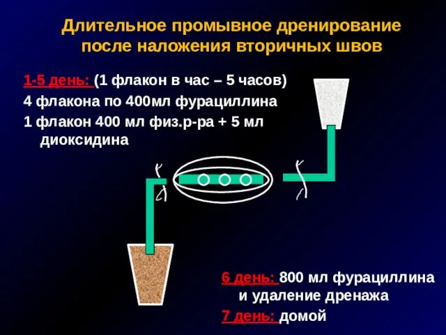 Длительное промывное дренирование после наложения вторичных швов 1-5 день: (1 флакон в