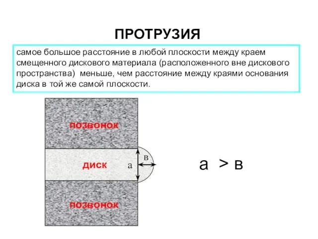 ПРОТРУЗИЯ самое большое расстояние в любой плоскости между краем смещенного дискового материала
