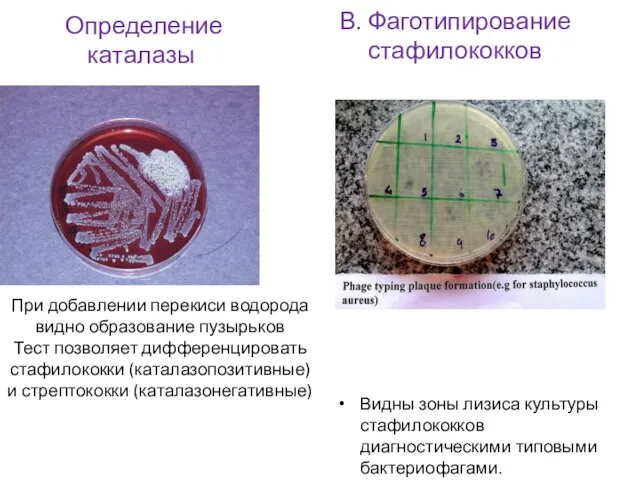 Определение каталазы При добавлении перекиси водорода видно образование пузырьков Тест позволяет дифференцировать