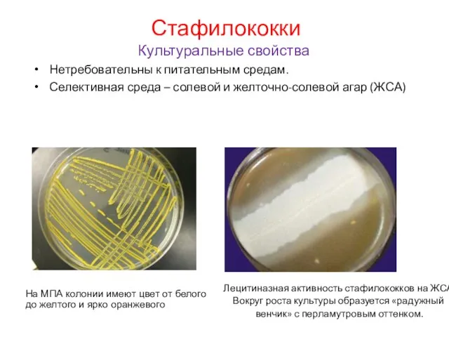 Стафилококки Культуральные свойства Нетребовательны к питательным средам. Селективная среда – солевой и