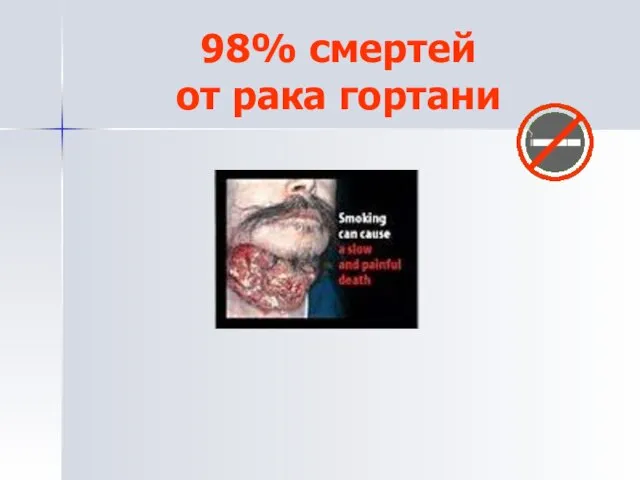 98% смертей от рака гортани