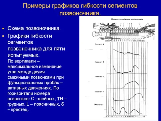 Примеры графиков гибкости сегментов позвоночника. Схема позвоночника. Графики гибкости сегментов позвоночника для