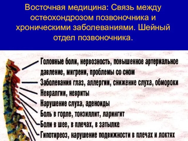 Восточная медицина: Связь между остеохондрозом позвоночника и хроническими заболеваниями. Шейный отдел позвоночника.