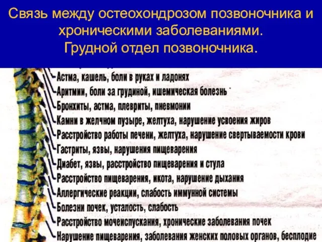 Связь между остеохондрозом позвоночника и хроническими заболеваниями. Грудной отдел позвоночника.