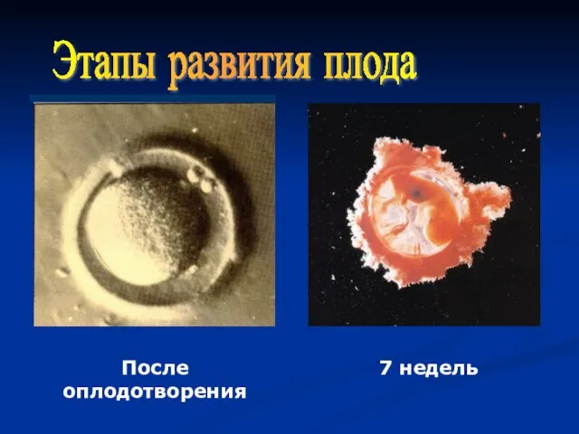 Этапы развития плода После оплодотворения 7 недель