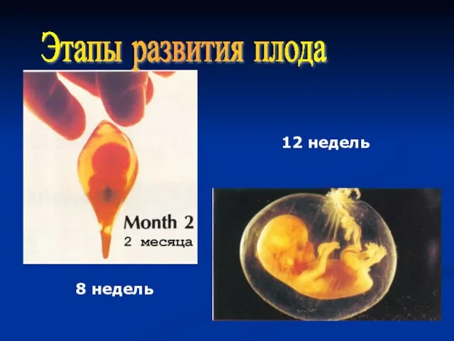 Этапы развития плода 12 недель 8 недель