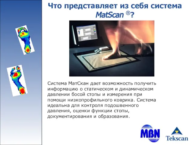 Что представляет из себя система MatScan ®? Система МатСкан дает возможность получить