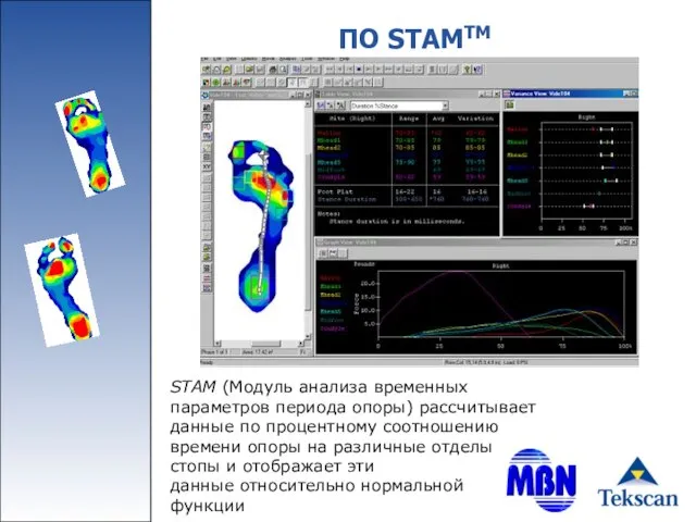 ПО STAMTM STAM (Модуль анализа временных параметров периода опоры) рассчитывает данные по