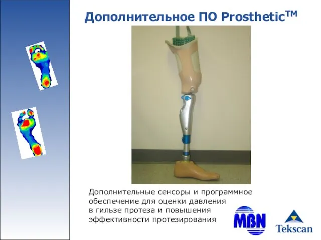 Дополнительное ПО ProstheticTM Дополнительные сенсоры и программное обеспечение для оценки давления в