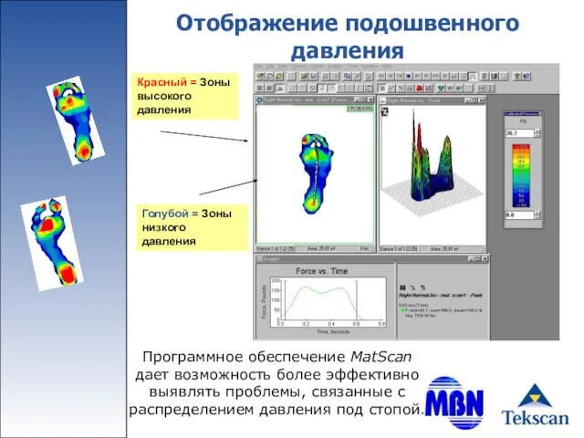 Отображение подошвенного давления Программное обеспечение MatScan дает возможность более эффективно выявлять проблемы,