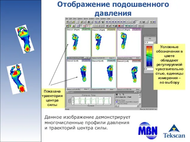 Отображение подошвенного давления Условные обозначения в цвете обладают регулируемой чувствительностью, единицы измерения