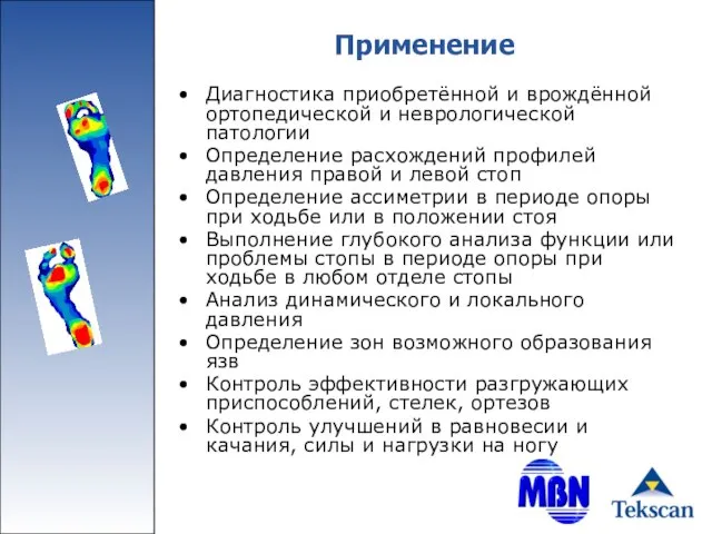 Применение Диагностика приобретённой и врождённой ортопедической и неврологической патологии Определение расхождений профилей